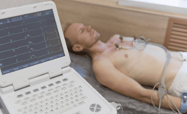 Electrocardiograma